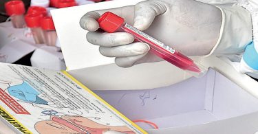 Bengaluru start-up rolls out mass testing tech