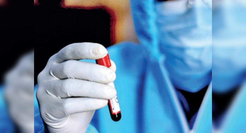 Covid Case multiplied in the second wave in the city of Kolhapur