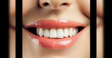 26% Not Realizing Cancer Screening Cavities Mouth: Survey