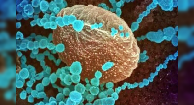 Faridabad man is Haryana’s only known Delta+ patient