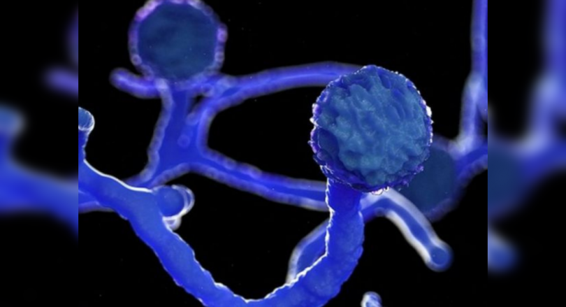 Mucormycosis: 160 deaths in Haryana so far, notify the court