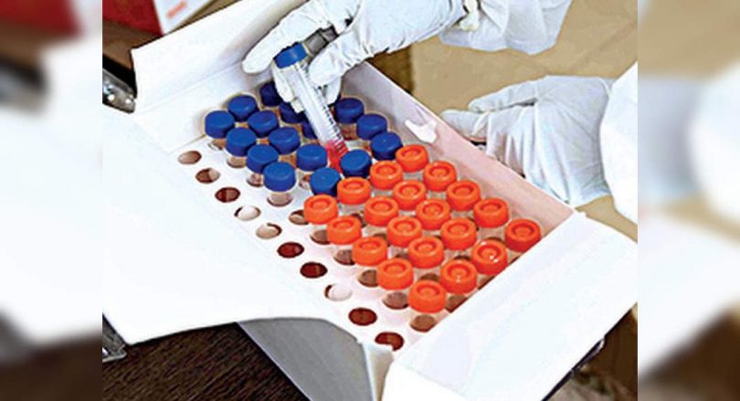 Purnia reports max 22 new Covid cases