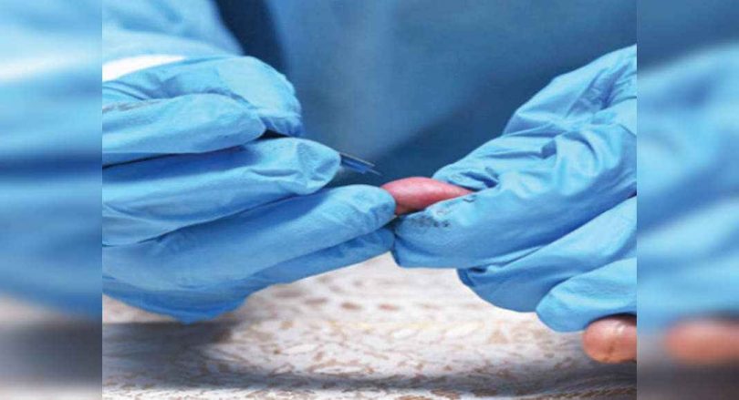 Surat city records 15 Covid cases on Friday