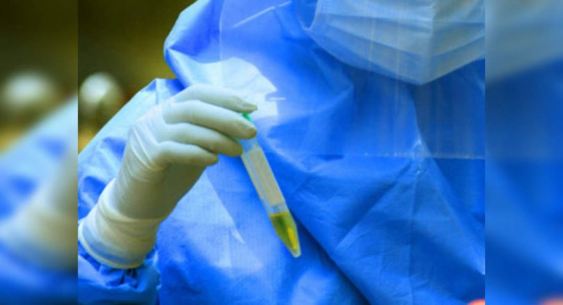 Himachal Pradesh added 118 new Covid cases, 2 deaths