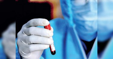 Post-covid blood clots cause gangrene in limbs, amputation is needed in the worst case