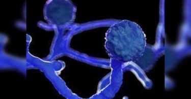 Vadodara: Women lost vision for black mushrooms, faces were saved