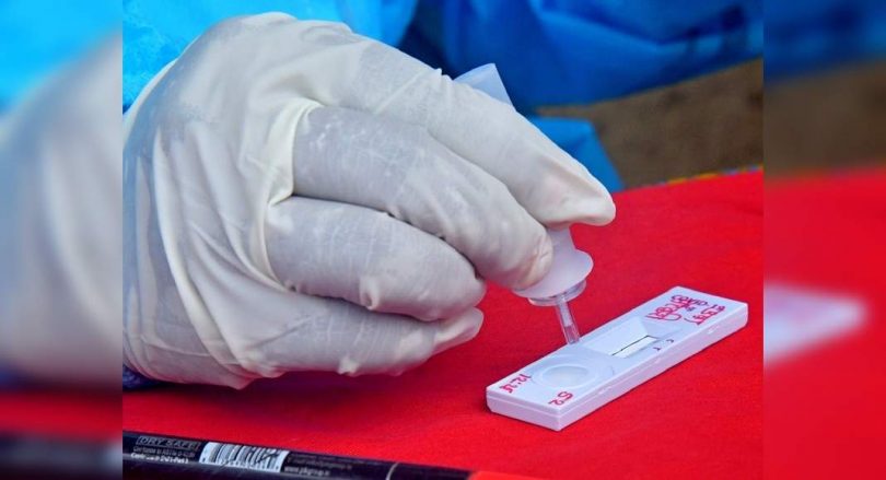 20 positive tests for Covid-19 in Rajasthan