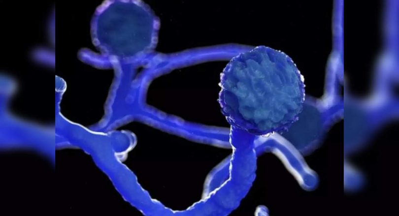 Nagpur: Doctors detect mucorikosis in the human intestine