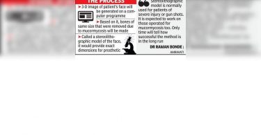 Hit with Mucor immediately after marriage, 27-year-old waiting facelift