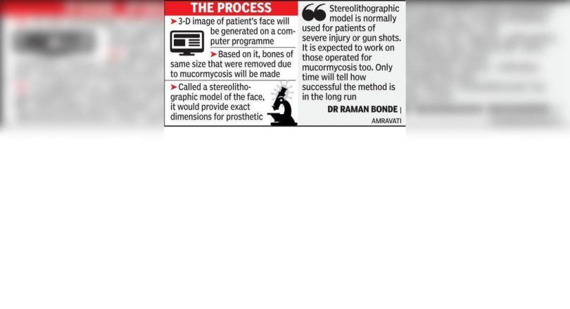 Hit with Mucor immediately after marriage, 27-year-old waiting facelift