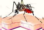 Dengue spread fast, platelets, lack of blood components hitting hompons