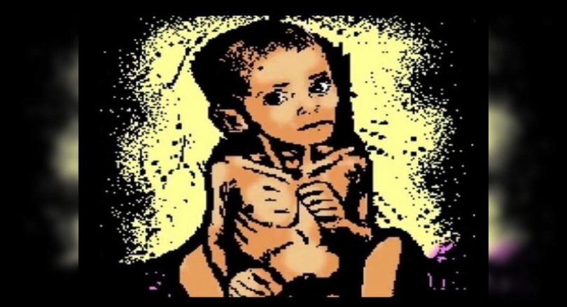 'Malnouriment root causes of low immunity in children'