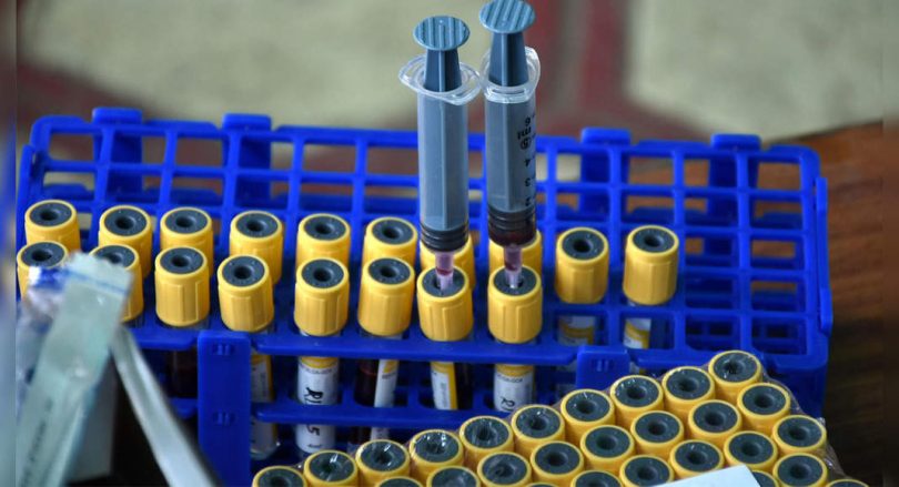 Covid-19: 69.8% Seroprevalence in Karnataka, said the ICMR survey