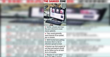 Defeat the mucor, but necrosis because of the surface of freezing