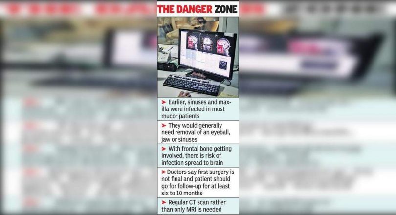 Defeat the mucor, but necrosis because of the surface of freezing