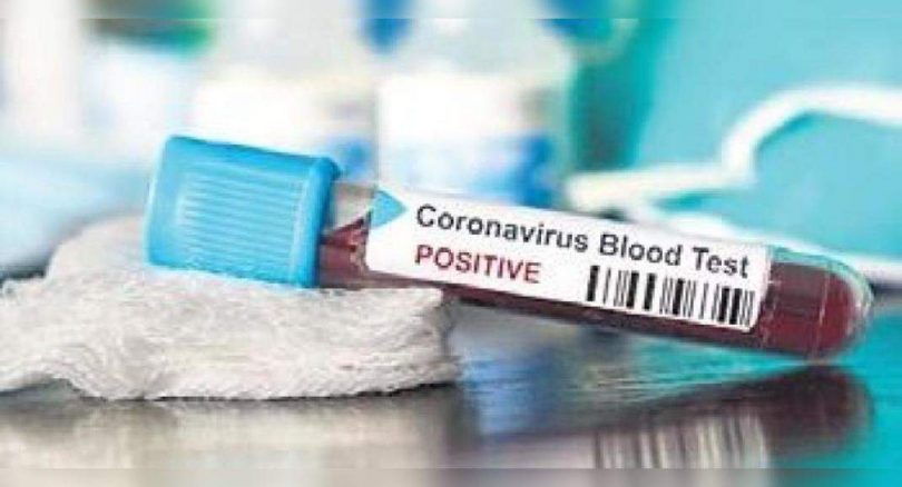 Fresh covid case in Tamil Nadu after 69 days