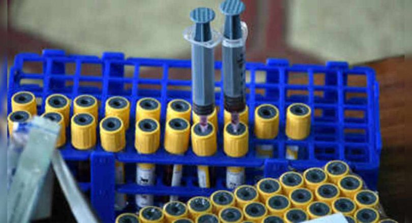 At 75.9%, Bihar has the 3rd highest seroprevalence in India