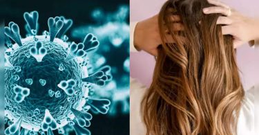 Post-covid hair loss is temporary, document words
