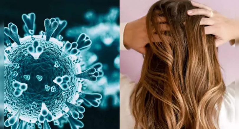 Post-covid hair loss is temporary, document words