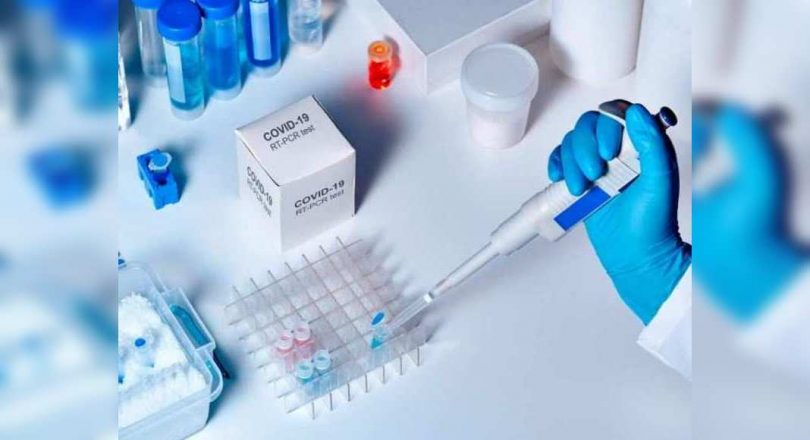 Health experts call on the RT-PCR test in Telangana