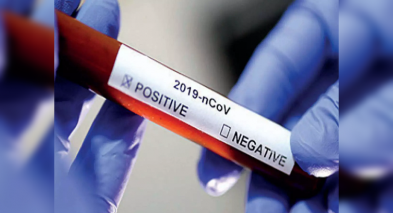 People who choose a free covid test in the government laboratory now in Maharashtra