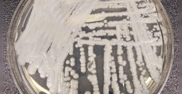 The 'untreated' superbug mushroom and the plague recently in the US: all you need to know