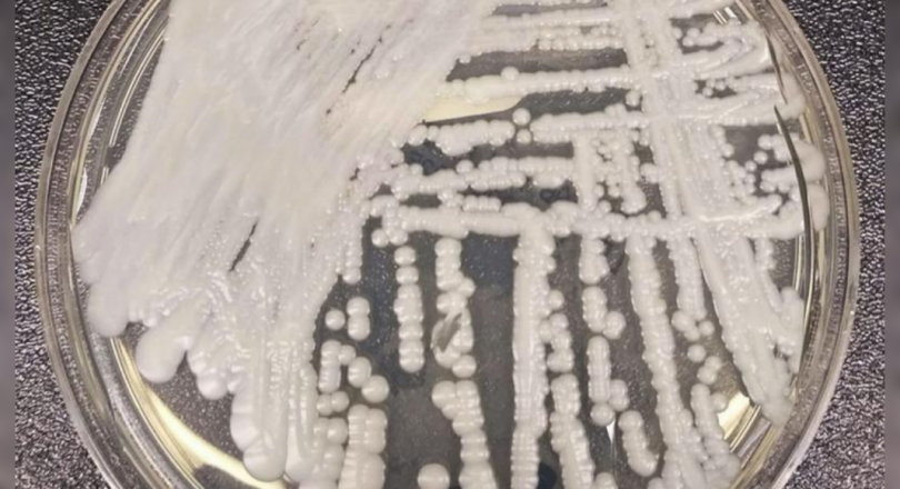 The 'untreated' superbug mushroom and the plague recently in the US: all you need to know