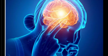 Delhi Hospital saw a neurological case increase