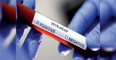 Covid-19: Kalyan-dombivli reported 80 new cases on Saturday