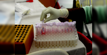 Doctor Delhi was first proven to suffer from a 3 covid infection