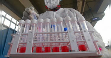 Kalyan-Dombivli Report 73 New Covid Case