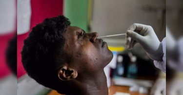 The Ministry of Health Uni recommends tuberculosis screening for all Positive Covid-19 patients