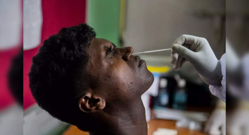 The Ministry of Health Uni recommends tuberculosis screening for all Positive Covid-19 patients