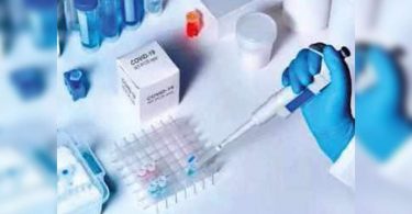 The RT-PCR report must be up to the top of the condition of the high casel