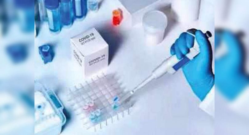 The RT-PCR report must be up to the top of the condition of the high casel