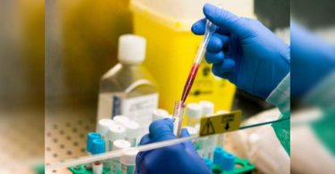 81% on AHD has antibodies: serosurvey reports