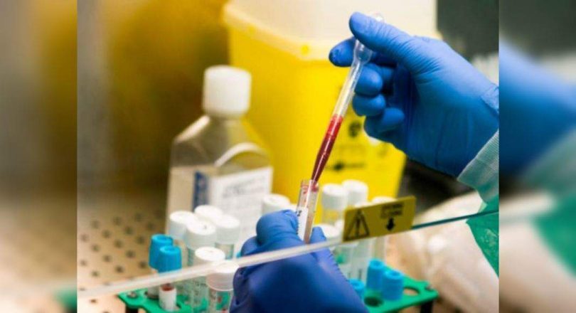 81% on AHD has antibodies: serosurvey reports