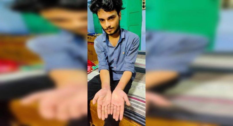 Agra: 19 years beaten by the police for suspicion of theft