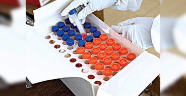 88 new Covid-19 cases, 3 deaths again in Bihar