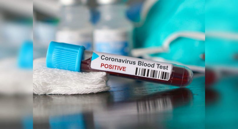 Mumbai reported 374 cases of Covid-19, 8 deaths