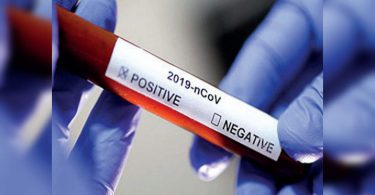 81 more positive tests for Covid in Bihar