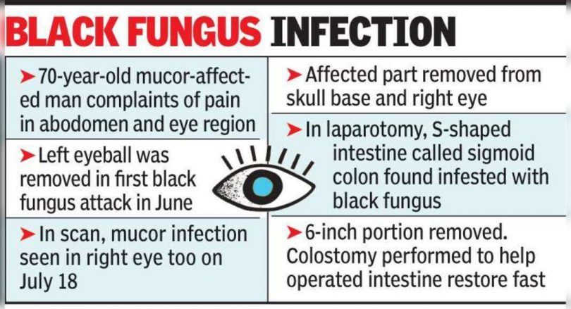 The doctor detected the mucor on the human intestine during a relapse operation