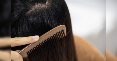 Hair care: DIY remedies for oily scalp