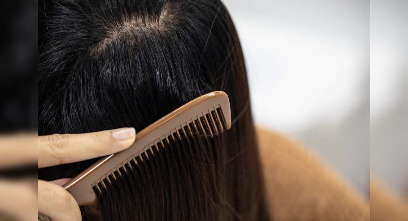 Hair care: DIY remedies for oily scalp