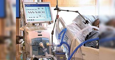 Karnataka has 3,400 ventilators; more can reduce death, say a doctor
