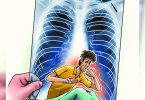 Patients who have recovered from Covid are vulnerable to tuberculosis
