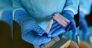 Delhi reported 19 new Koronavirus cases