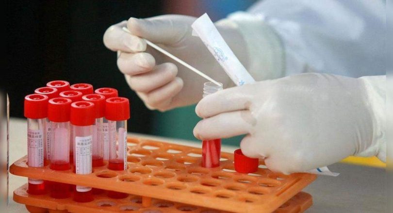 Delhi: No Covid Death in the last 24 hours, 57 new cases