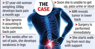 Paraplegic women walk again after the spinal surgery