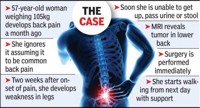 Paraplegic women walk again after the spinal surgery